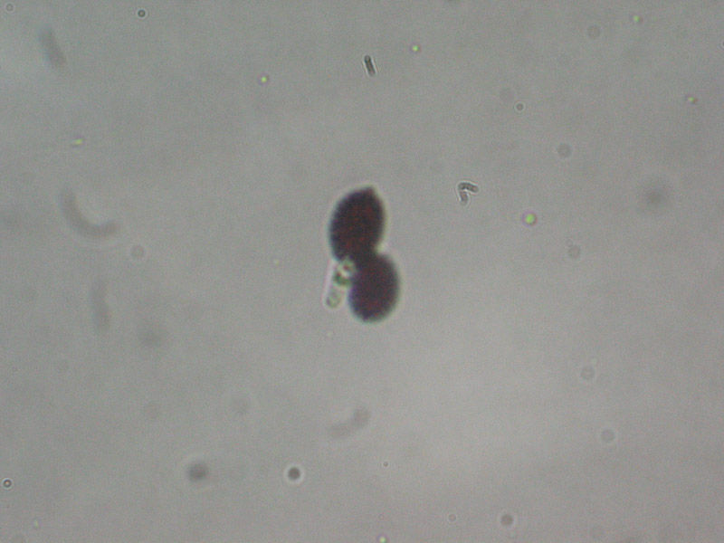 Coprinopsis echinospora